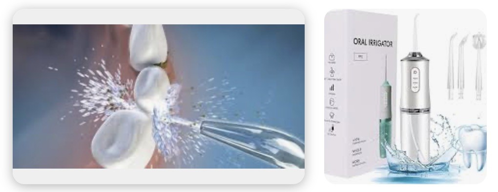De Beste Waterflosser: Jouw Ultieme Gids voor Mondverzorging in 2024