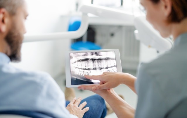 Wortelkanaalbehandeling: Alles Wat Je Moet Weten