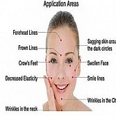 Access Facelift