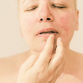Aften: Oorzaken, Symptomen en Effectieve Behandeling