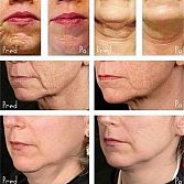 Anti-Aging 