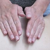 Breuss massage in Heerenveen