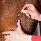 Dry needling