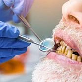 Tandplak en tandsteen: complete gids voor gebitsreiniging, mondhygiene en tanden schoonmaken