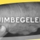Verzuimbegeleiding