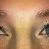 Wimperextensions